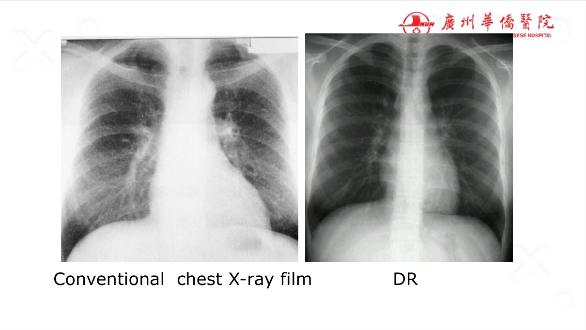 Case-based learning — the elective runs clinical cases (presentation → imaging → differential → diagnosis), mirroring the OSCE film-reading station.