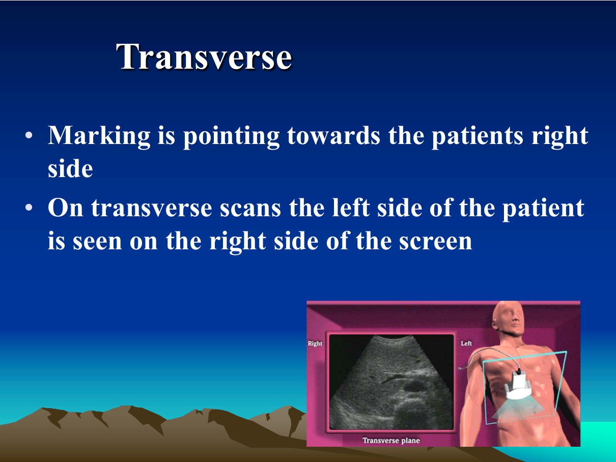 3D/4D ultrasound — volume acquisition with multiplanar reconstruction and surface rendering for fetal anomaly assessment.