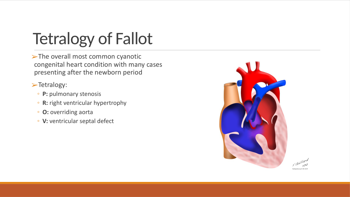 Congenital heart imaging — ASD/VSD/PDA show cardiomegaly + pulmonary plethora; TOF shows boot-shaped heart with pulmonary oligaemia.