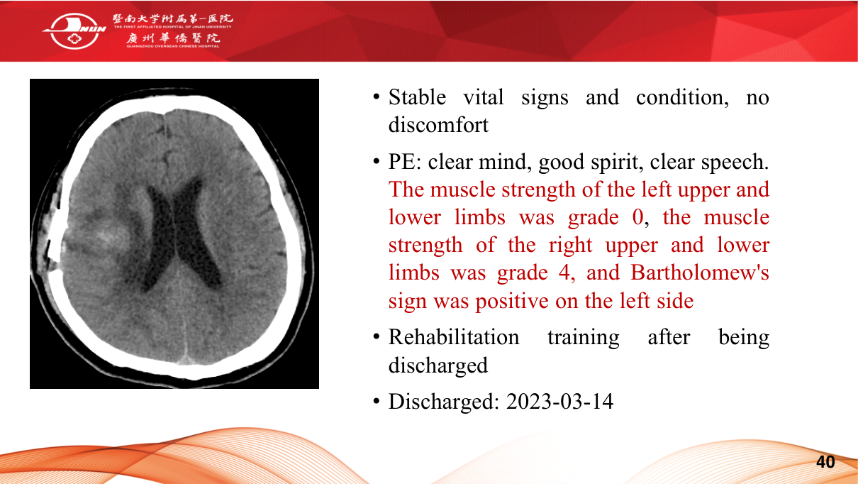 Acute ischaemic stroke — NCCT excludes bleed (early signs: dense MCA, loss of grey-white), MRI-DWI shows bright restricted diffusion within minutes; CTA/CTP for LVO and penumbra.