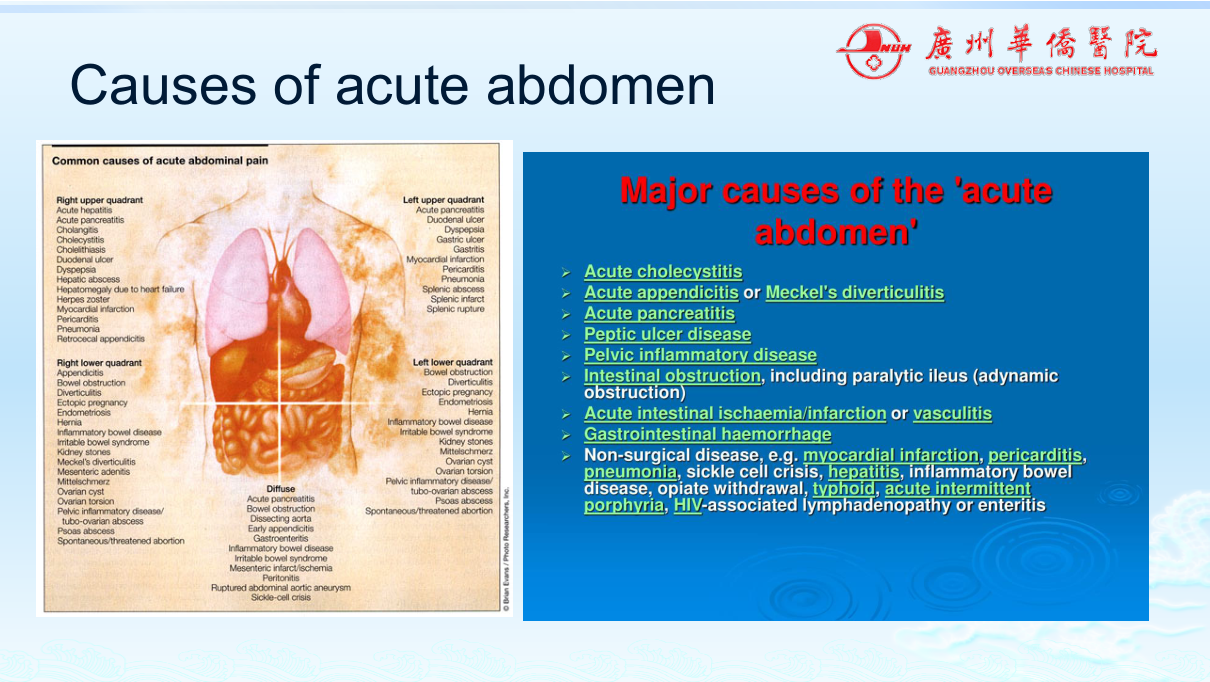 Acute abdomen — free air under the diaphragm on erect CXR (perforation), dilated small bowel with air-fluid levels (SBO), and the surgical inflammatory triad (appendicitis, cholecystitis, pancreatitis) on CT.