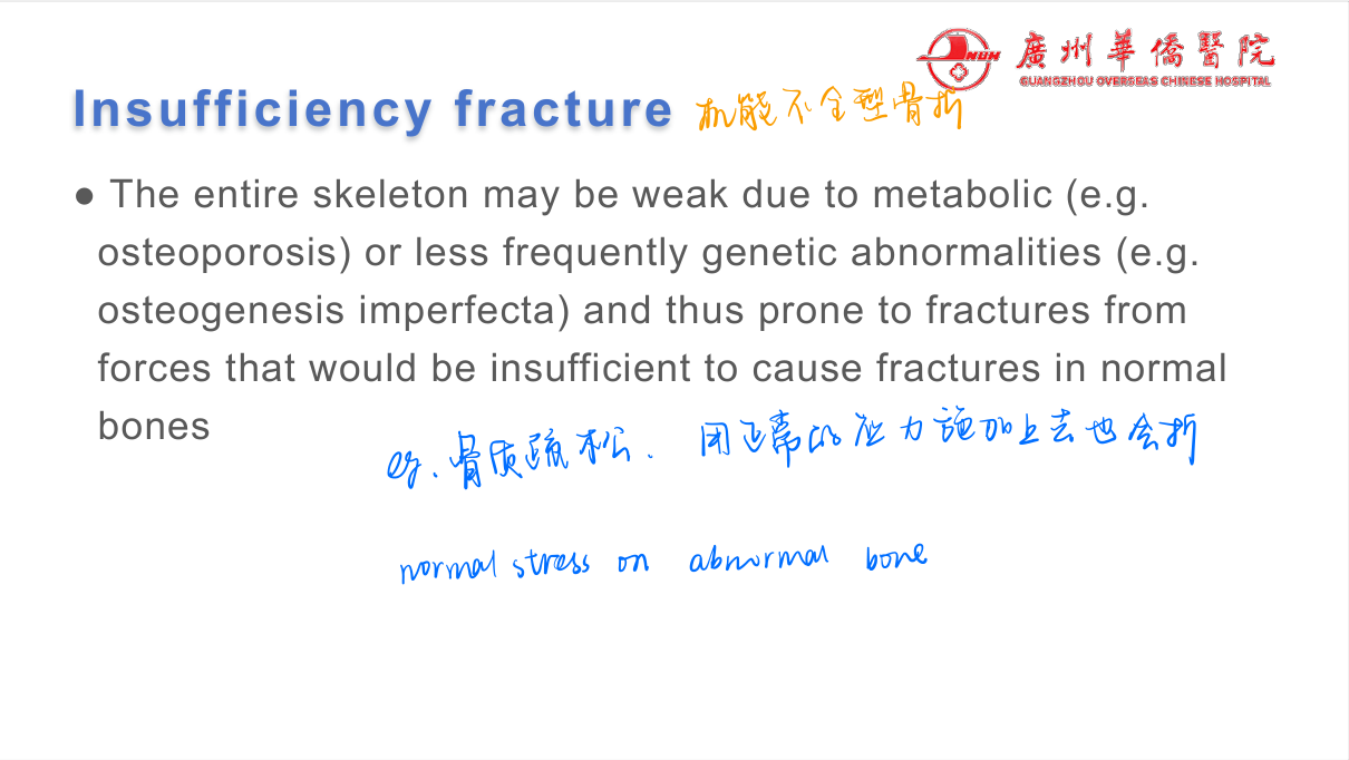 Fractures — systematic description (location, pattern, displacement); Colles (dinner-fork, dorsal), scaphoid (AVN risk), femoral neck (elderly), supracondylar (child, neurovascular risk).