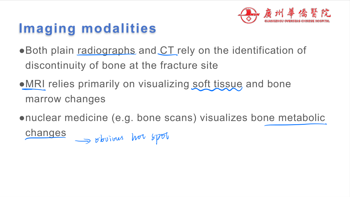 Bone tumours by age + location — osteosarcoma (adolescent metaphysis, sunburst), Ewing (child diaphysis, onion-peel), giant cell (epiphysis, soap bubble), metastasis (elderly, multiple).