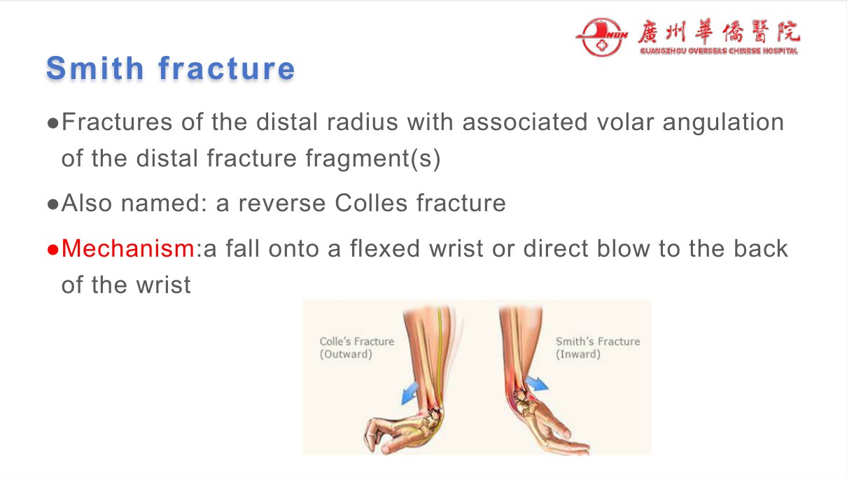 Periosteal reactions — interrupted/sunburst (malignant, osteosarcoma), onion-peel (Ewing), Codman triangle — vs benign solid/sclerotic reactions.
