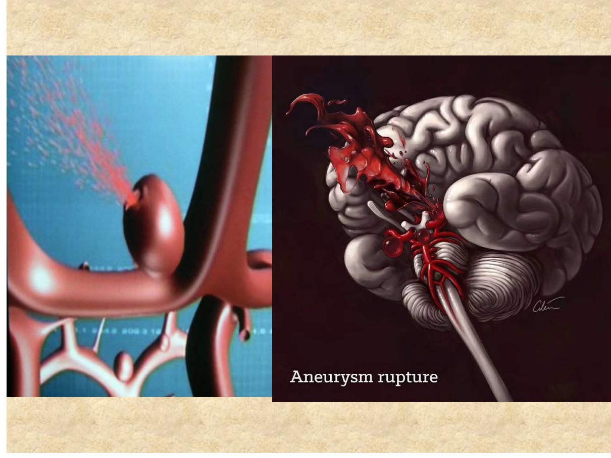 IR procedures — percutaneous abscess drainage, CT-guided biopsy, biliary drainage/stenting, and TIPS for portal hypertension.