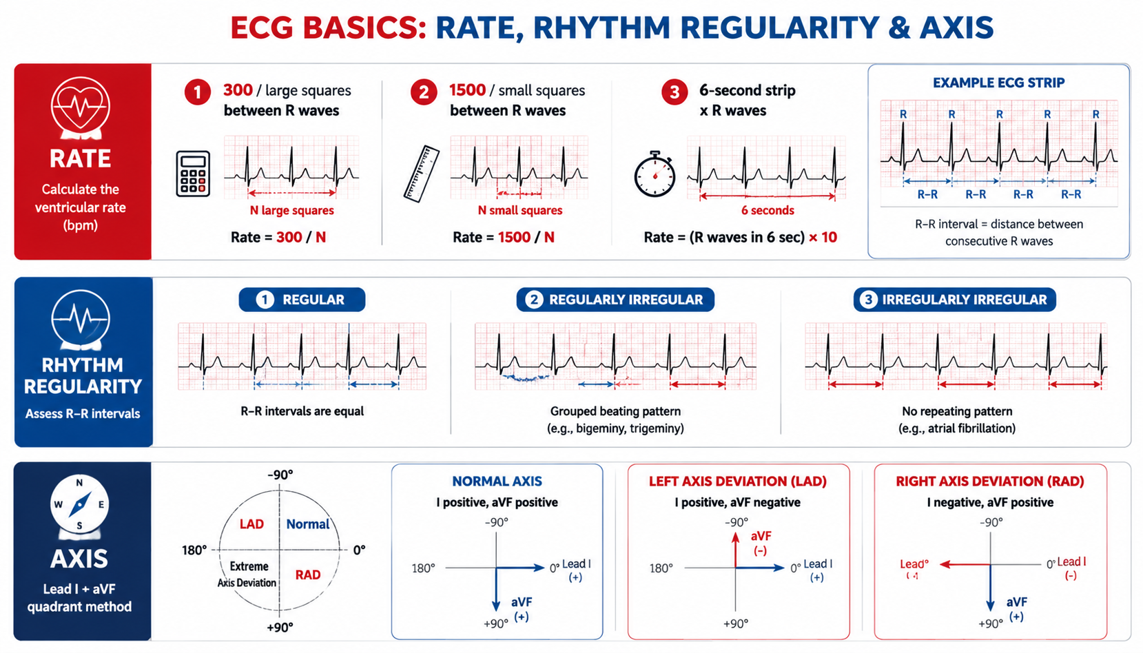 ECG rate calculation + rhythm regularity + axis (心电图心率计算与节律判断速查)