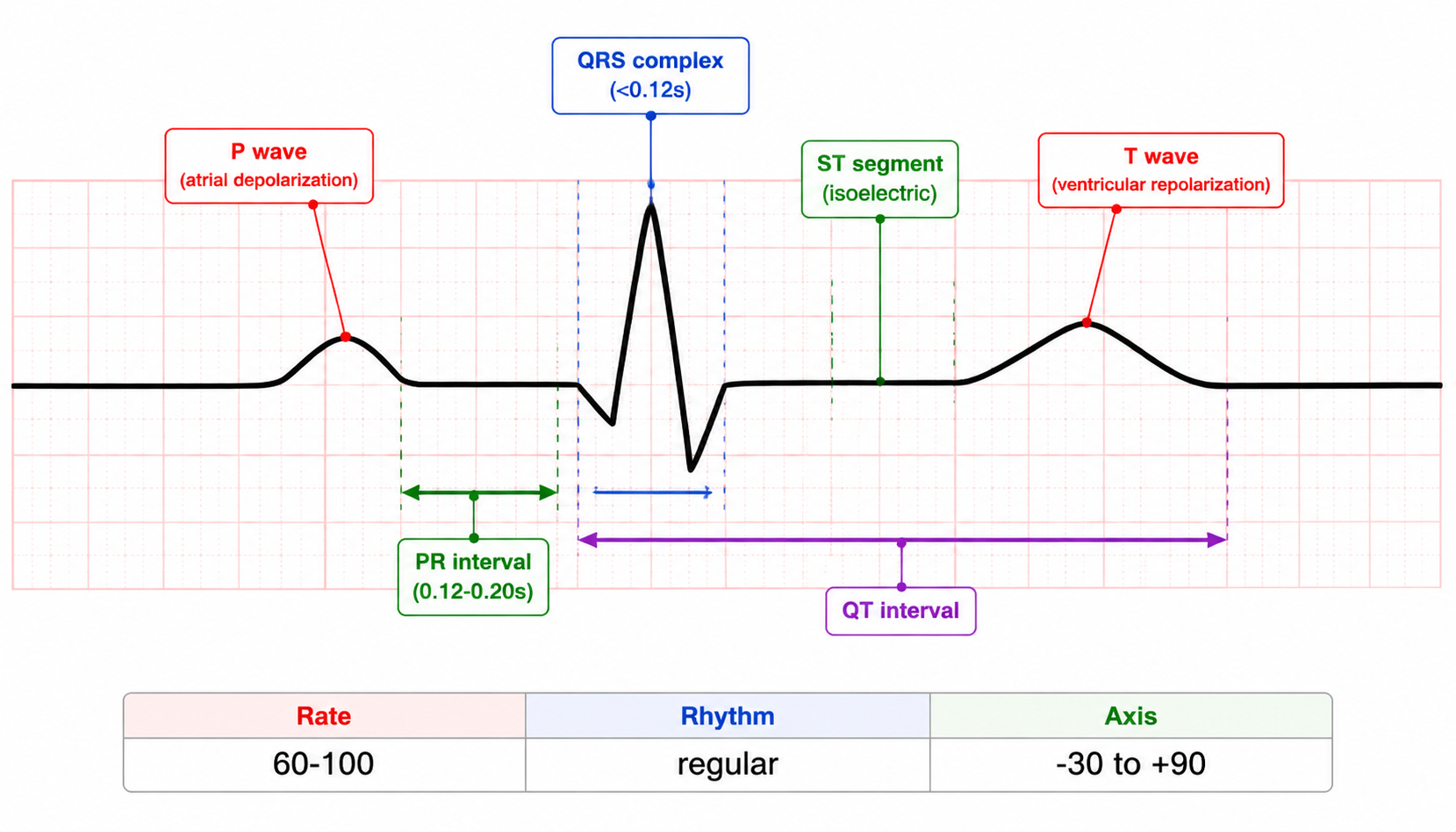 Normal ECG — P-QRS-T complex anatomy with intervals and normal values (正常心电图:P-QRS-T复合波与间期正常值)