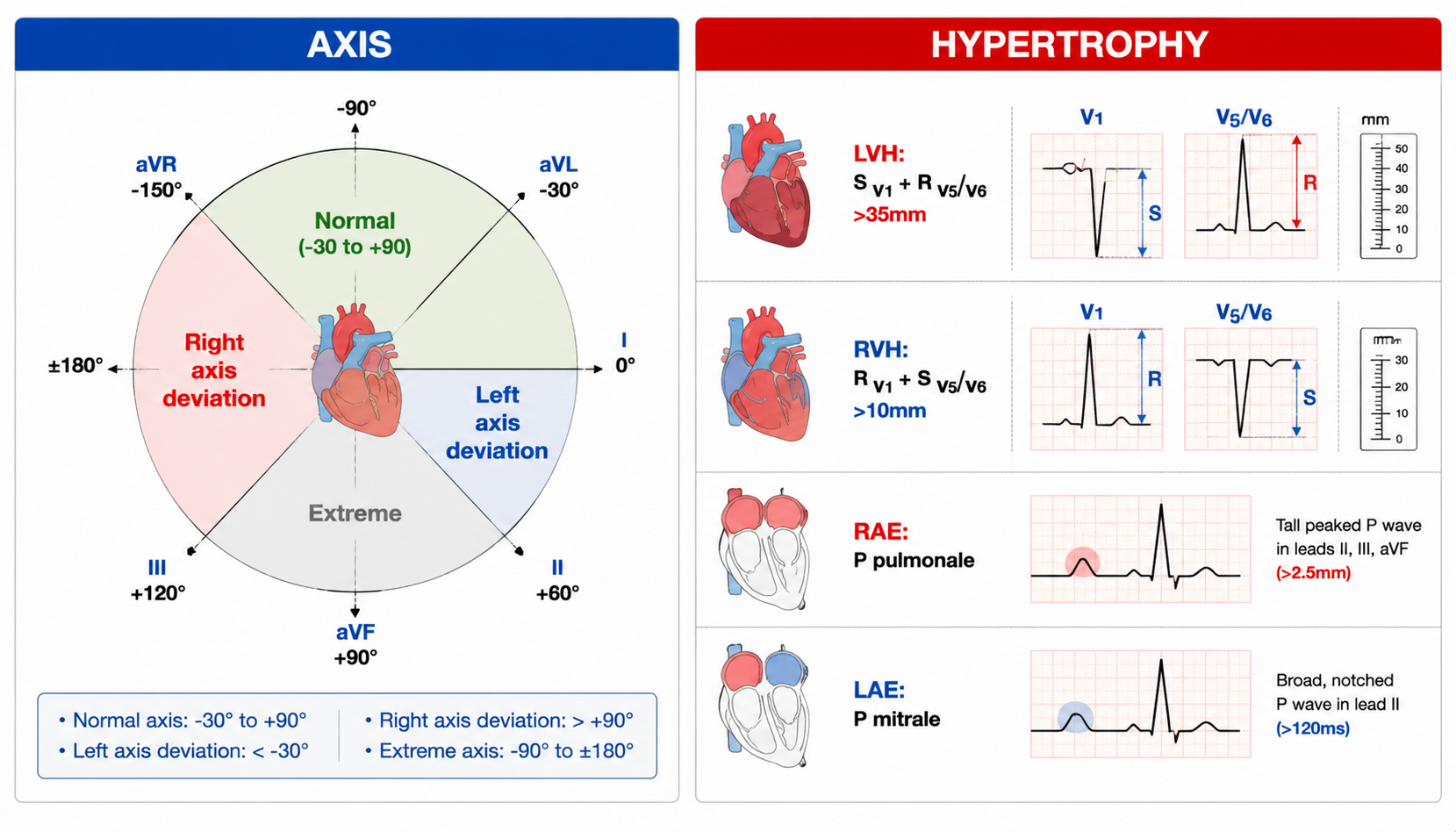 ECG axis determination + chamber hypertrophy criteria (心电图电轴与心房心室肥大标准)