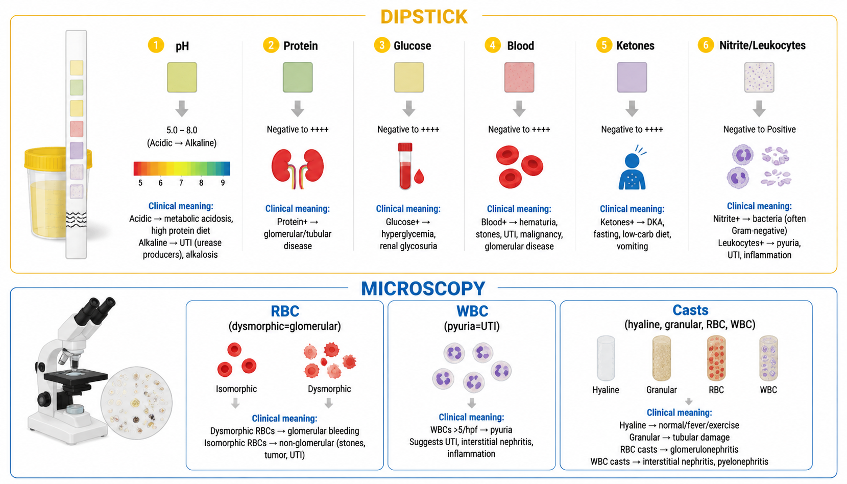 Urinalysis — dipstick parameters + microscopy (尿常规：试纸检测与镜检解读)