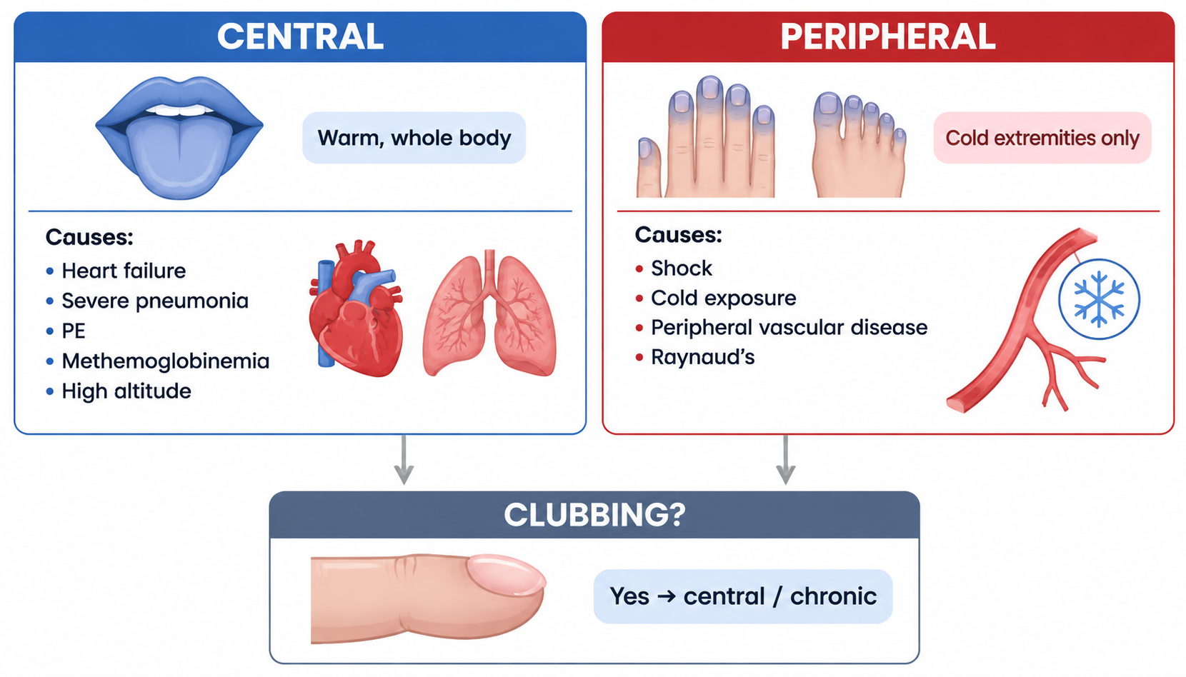 Cyanosis — central vs peripheral differentiation + causes + clubbing clue (发绀:中心性与周围性鉴别)