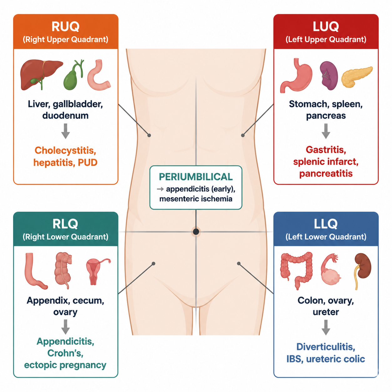 Abdominal pain by quadrant — organs and common pathologies (腹痛:四象限定位与常见病因)