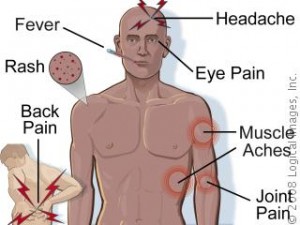 Classic dengue symptoms — fever, retro-orbital pain, myalgia, arthralgia ("breakbone fever"), headache, rash.
