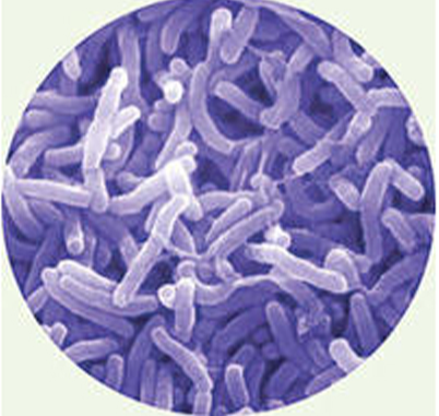 *Vibrio cholerae* — comma-shaped Gram-negative bacterium with single polar flagellum.