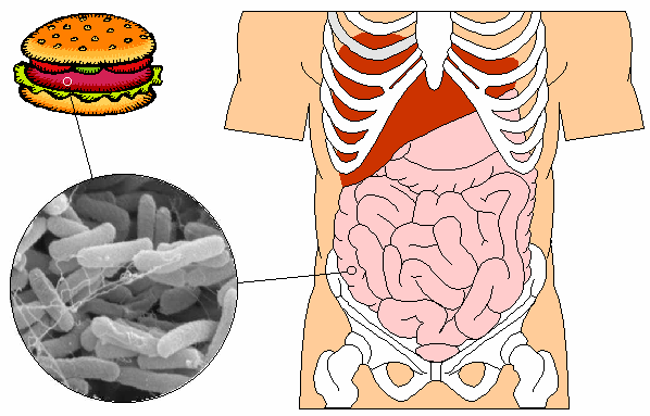 Colonic invasion by Shigella — sigmoid colon and rectum are the primary sites; fibrinopurulent inflammation, necrosis, and ulceration produce the classic mucoid-bloody stool.