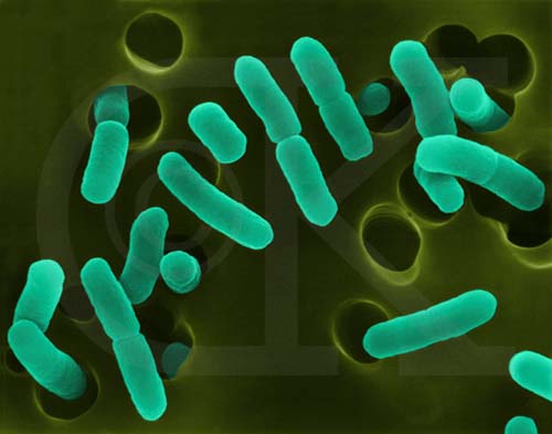 *Shigella* — Gram-negative non-motile rod, facultative intracellular; invasive in colonic epithelium.