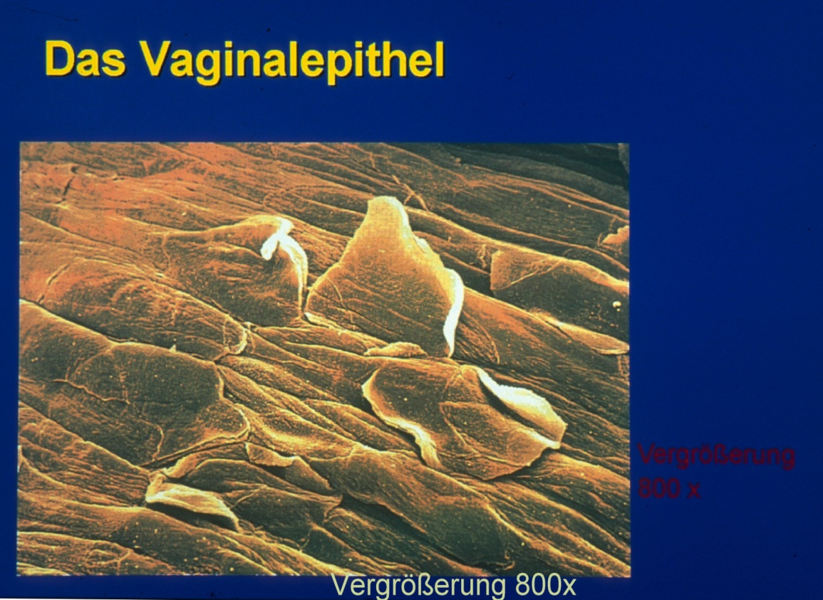 Female genital tract anatomy — the lower tract (vulva, vagina, cervix) and upper tract (uterus, tubes, ovaries); infection ascends to cause PID.