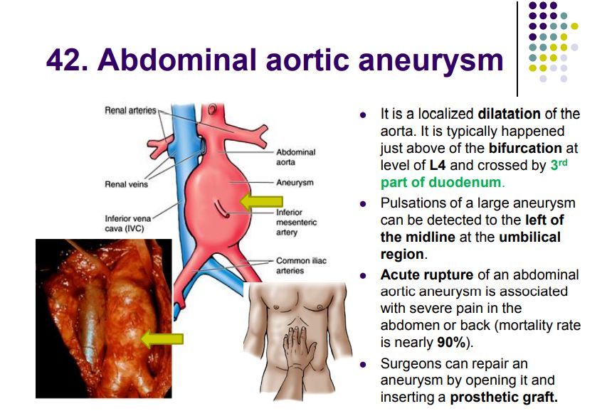 Regional anatomy diagram