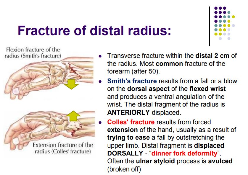 Regional anatomy diagram